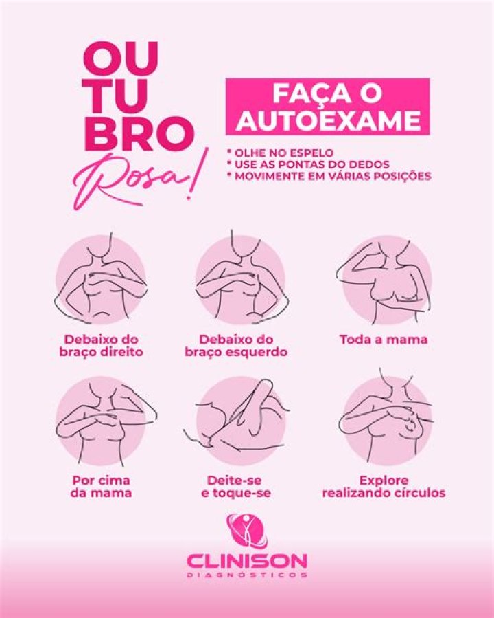 Como fazer o exame de toque das mamas?