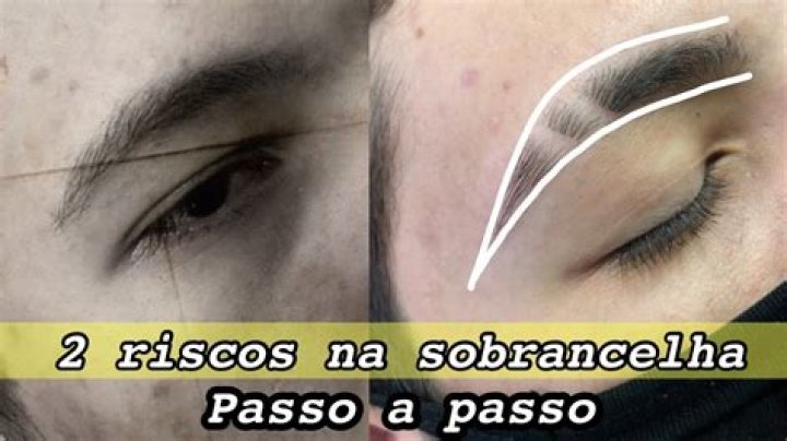 Quanto tempo demora para crescer o risco na sobrancelha?